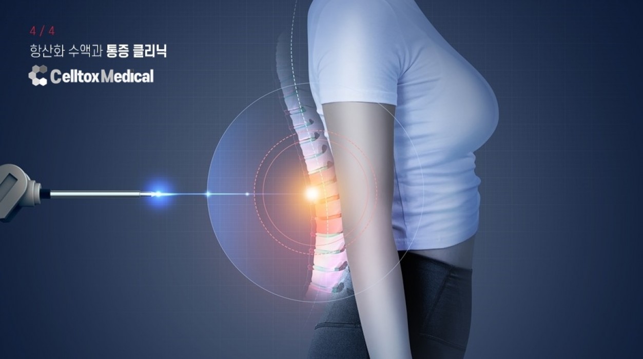 셀톡스 의료장비 이미지 2